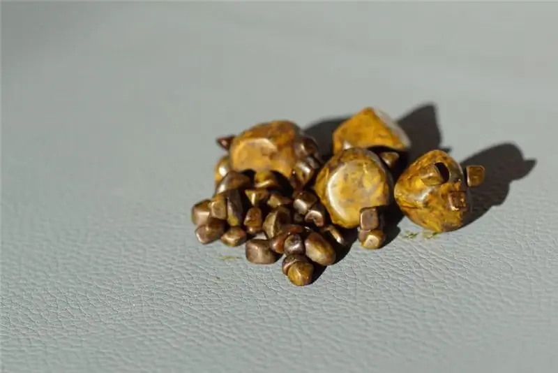 желчные камни