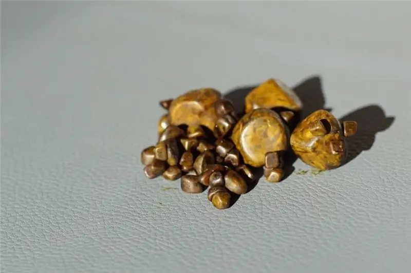 Расшифровка: так образуются желчные и мочевые камни