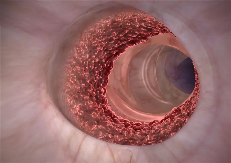 Расшифрован естественный механизм защиты от рака толстой кишки: как иммунная система защищает нас от опухолей