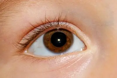 Малиновый язык и чесоточные клещи – Типичные заболевания у детей