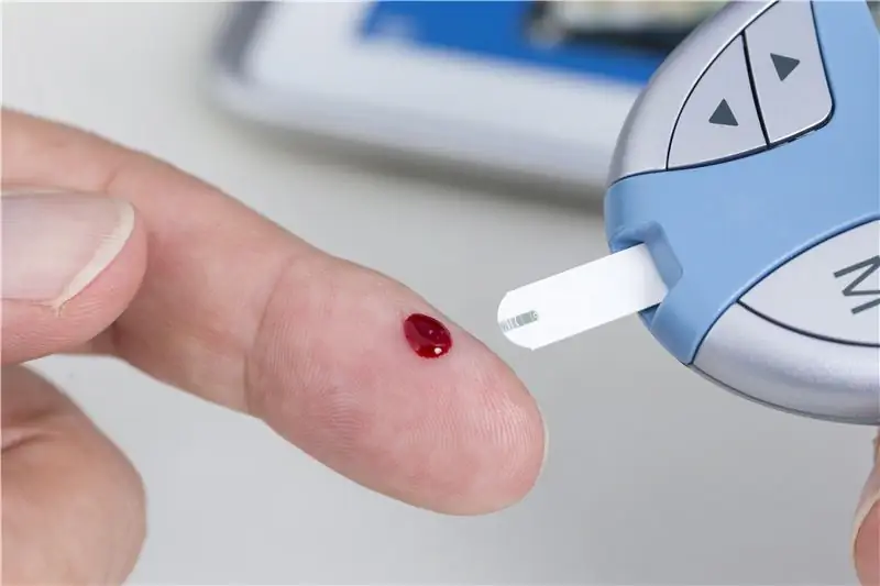 Диабет 2 типа: определение уровня глюкозы в крови из пальца может быть ненадежным