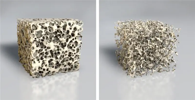 Сравнение костной структуры при остеопорозе. Изображение: Аксель Кок - fotolia