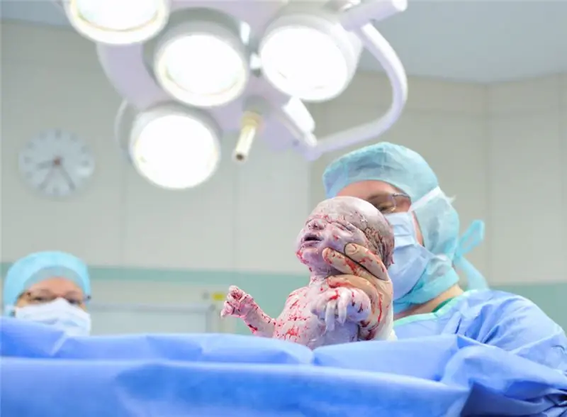 Кесарево сечение следует проводить только в том случае, если существует риск для здоровья матери или ребенка. По-видимому, слишком много родов происходит путем кесарева сечения. По этой причине Федеральное министерство здравоохранения наградило четыре исследовательских проекта по этой теме. (Изображение: GordonGrand/fotolia.com)