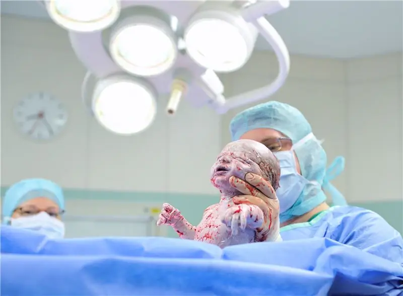 Федеральное министерство здравоохранения начинает исследовательские проекты по кесареву сечению