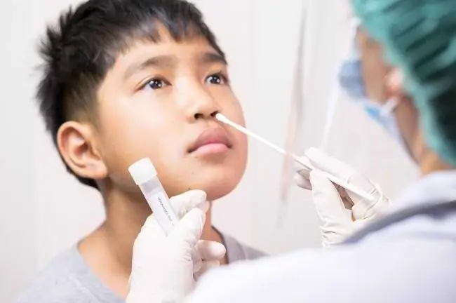 Экспресс-тест на антиген, вот что вам следует знать - Alodokter