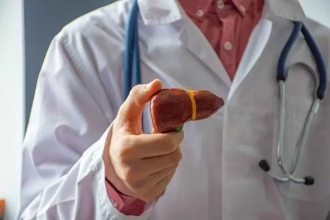 Факты о распространении гепатита В в Индонезии - Alodokter Факты о распространении гепатита В в Индонезии - Alodokter