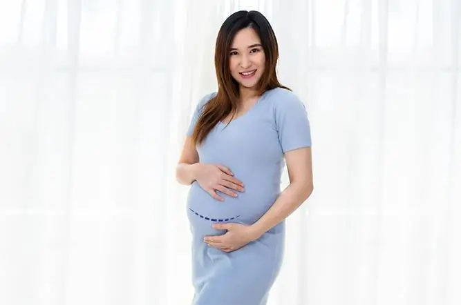 Побочные эффекты кесарева сечения на иммунную систему ребенка