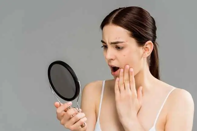 4 Эти проблемы с кожей могут быть результатом стресса на коже