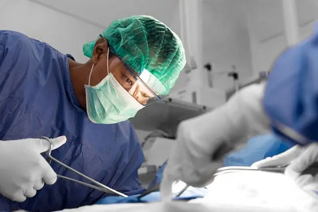 Знать порядок наложения стомы на желудок и ее лечение - Alodokter