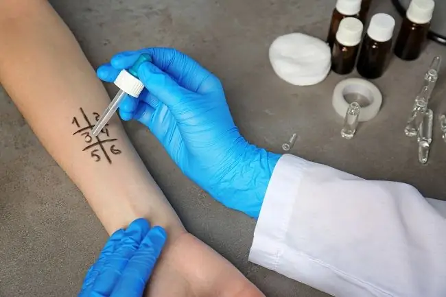 Тест на аллергию, вот что вам следует знать