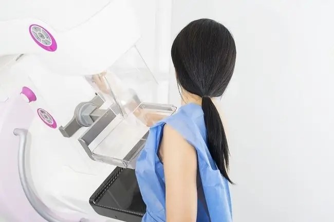 Ряды обследований здоровья для женщин, которые необходимо пройти - Alodokter
