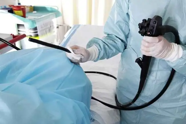 Колоноскопия, процедура раннего выявления рака толстой кишки - Alodokter
