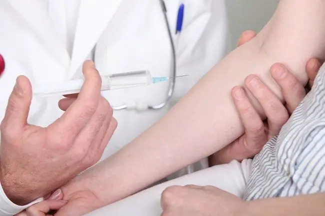 Понимание функций пробы Манту и выполняемых процедур - Alodokter