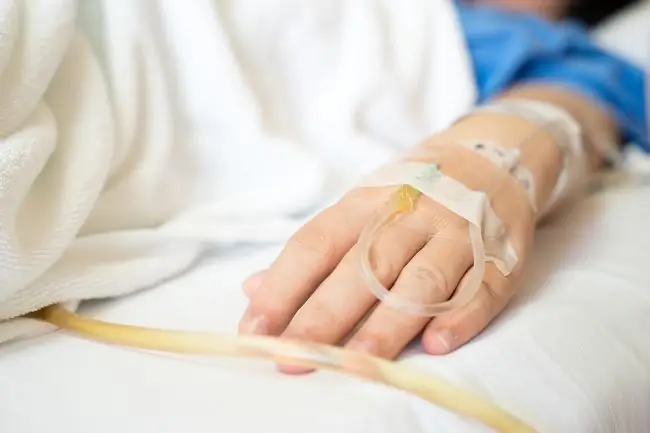 Различные заболевания, вызванные бактериями, за которыми нужно следить - Alodokter