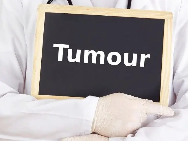 Некоторые часто используемые методы лечения опухолей и препараты - Alodokter Некоторые часто используемые методы лечения опухолей и препараты - Alodokter
