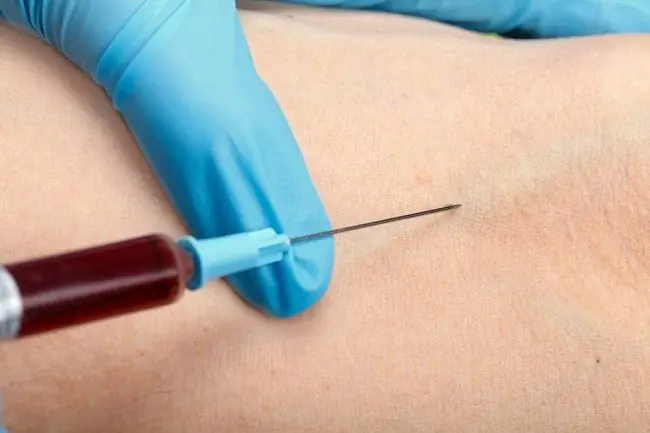 Знайте типы и функции анализов крови - Alodokter