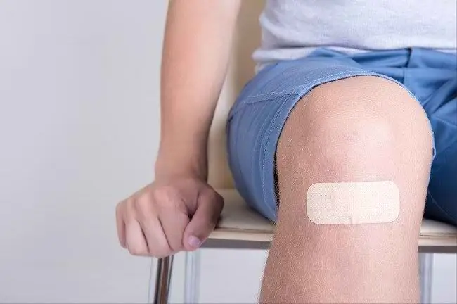 Познакомьтесь с процессом свертывания крови - Alodokter Познакомьтесь с процессом свертывания крови - Alodokter