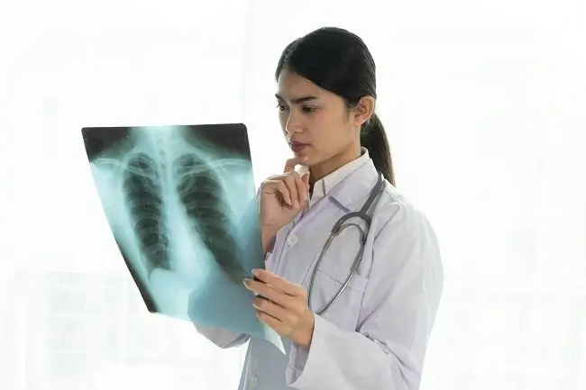 Абсцесс легкого - Симптомы, причины и лечение