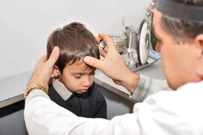 Гидроцефалия - Симптомы, причины и лечение