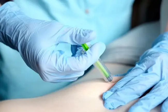 Базиликсимаб - Преимущества, дозировка и побочные эффекты