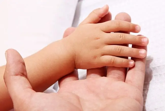 Синдром Нунан - Симптомы, причины и лечение