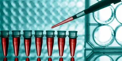 Когда тело сходит с ума