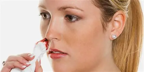 Как предотвратить кровотечение из носа