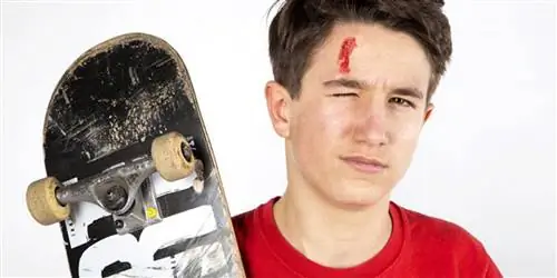 Черепно-мозговые травмы – часто после падения