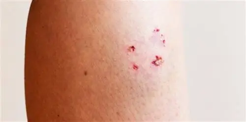 Как лечить повреждения кожи?