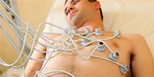 Сердечная недостаточность – Симптомы развиваются постепенно