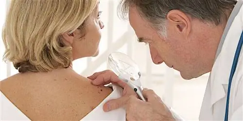 Правильная интерпретация новообразования кожи: рак кожи или фиброма?