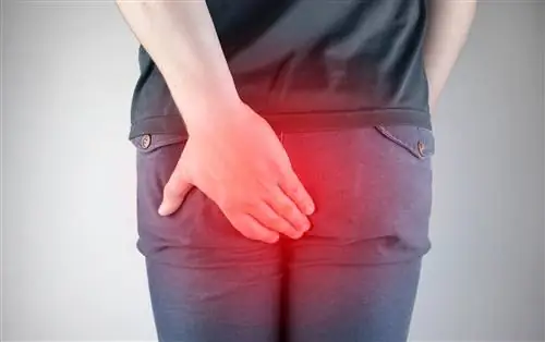 Геморрой 4 степени: поэтому часто необходима операция