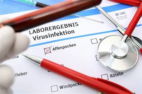 Вспышка оспы обезьян: детский сад закрыт