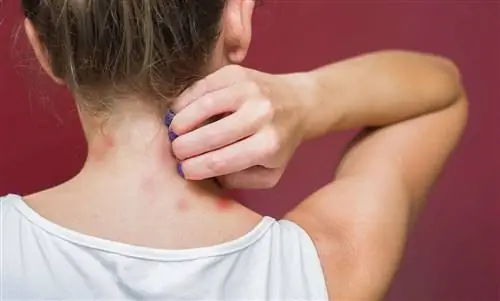 Красные пятна на шее: причины и лечение
