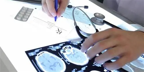 Что эпилепсия делает с мозгом?