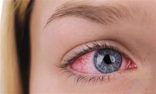 Загар на глазах: возможен ли?