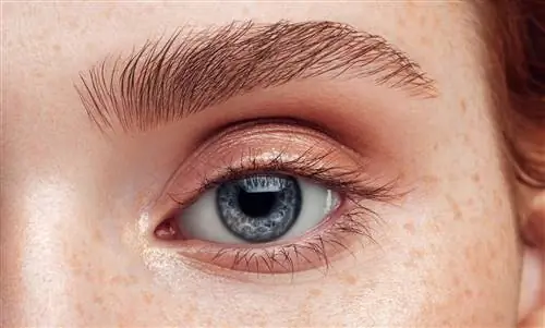 Подтяжка бровей: что стоит за новой бьюти-тенденцией