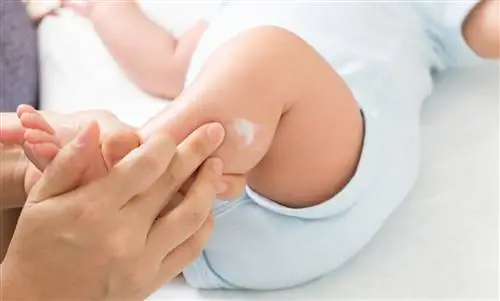 Сухая кожа у младенцев: причины и что помогает