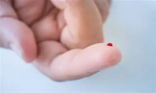 Домашний анализ крови: насколько он надежен и эффективен на самом деле?