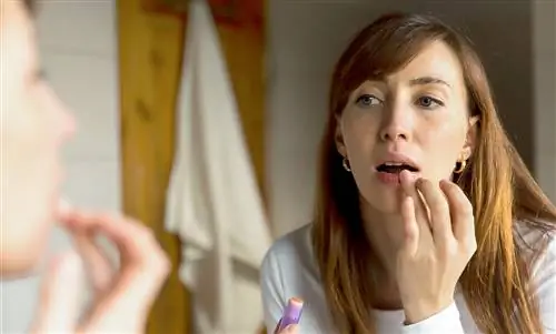 Сухие губы – что делать? Эти 5 домашних средств помогут