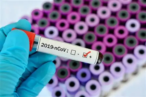 Коронаположительный результат после прививки: 7 возможных причин