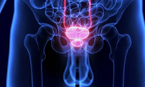 Проблемы с простатой: мужчинам это под силу