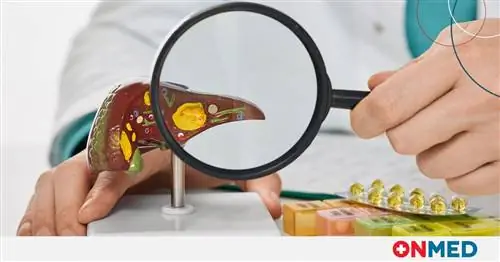 Жировая инфильтрация: что включает диета для борьбы с ней