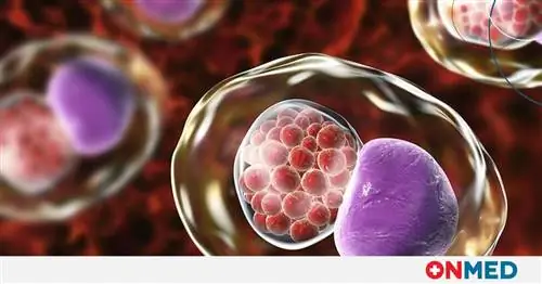 Хламидии или трихомонады? Различные симптомы, диагностика и лечение