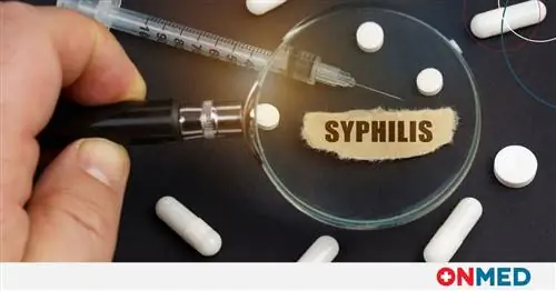 Резкое увеличение случаев заражения сифилисом - Каковы симптомы?
