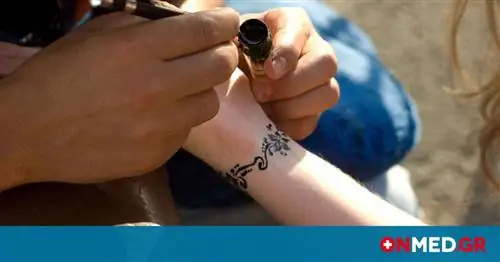 Татуировки черной хной: почему их следует избегать
