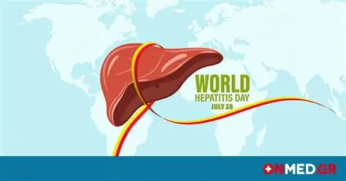 Вирусный гепатит: предполагаемые симптомы (фото)