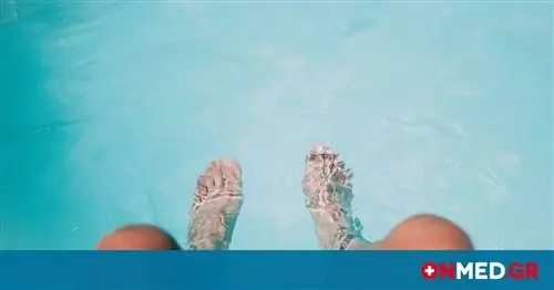 Грибок стопы летом: как его избежать