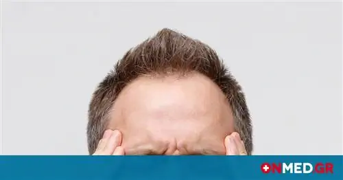 Коронавирус: тромбоз церебрального венозного синуса у пациентов с COVID-19