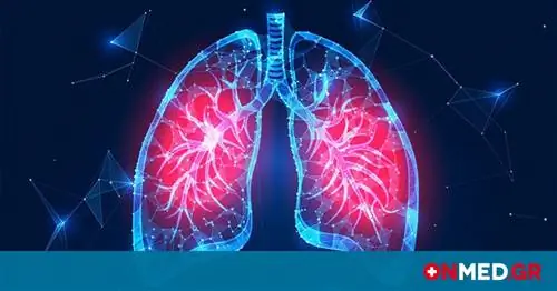 Лечение рака легких: жизненно важна ранняя диагностика